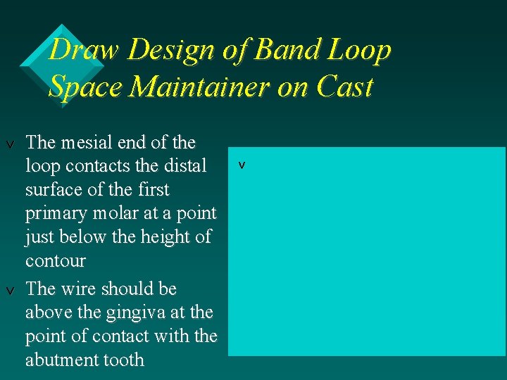 Draw Design of Band Loop Space Maintainer on Cast v v The mesial end