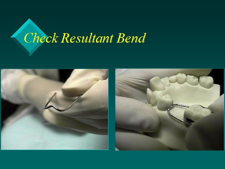 Check Resultant Bend 