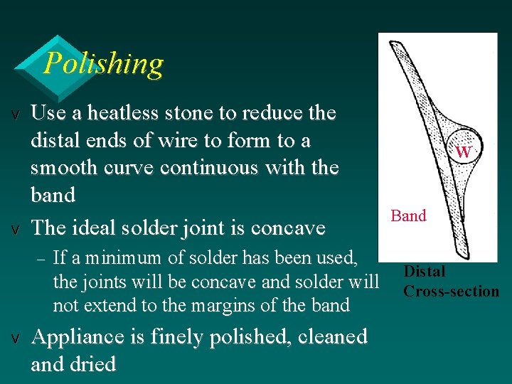 Polishing v v Use a heatless stone to reduce the distal ends of wire