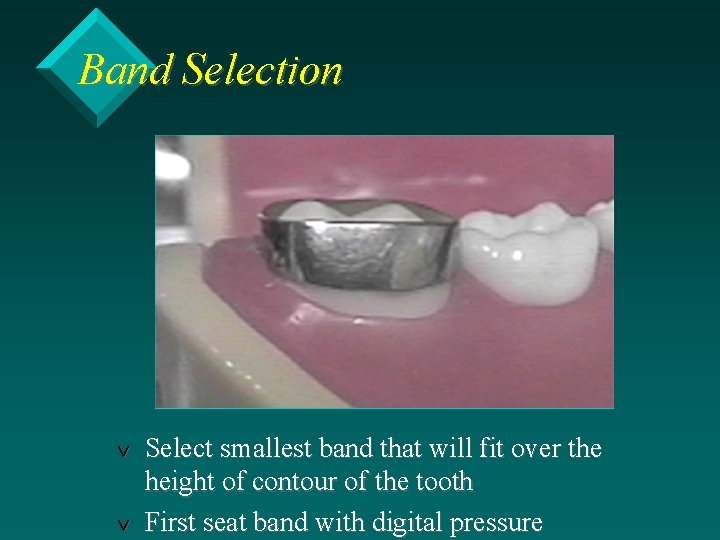 Band Selection v v Select smallest band that will fit over the height of