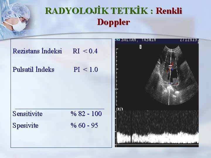RADYOLOJİK TETKİK : Renkli Doppler Rezistans İndeksi RI < 0. 4 Pulsatil İndeks PI