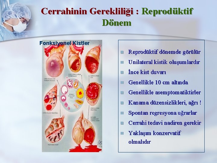 Cerrahinin Gerekliliği : Reprodüktif Dönem Fonksiyonel Kistler n Reprodüktif dönemde görülür n Unilateral kistik