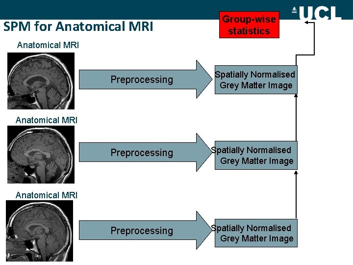SPM for Anatomical MRI Group-wise statistics Anatomical MRI Preprocessing Spatially Normalised spm T Grey
