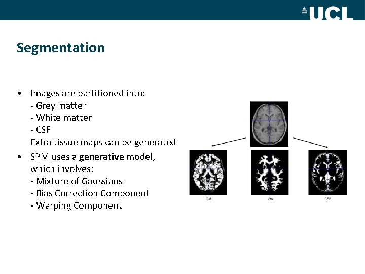 Segmentation • Images are partitioned into: - Grey matter - White matter - CSF