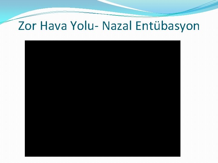 Zor Hava Yolu- Nazal Entübasyon 