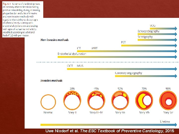 Uwe Nixdorf et al. The ESC Textbook of Preventive Cardiology, 2015 Uwe Nixdorf et al. The ESC Textbook of Preventive Cardiology, 2015