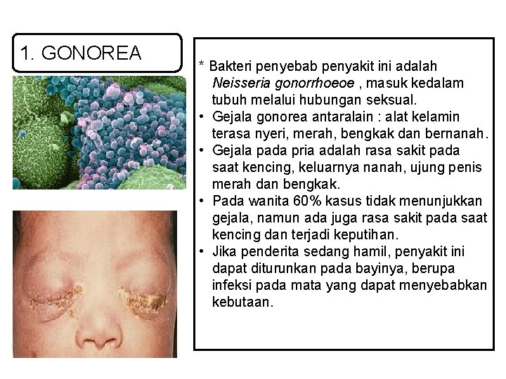 1. GONOREA * Bakteri penyebab penyakit ini adalah Neisseria gonorrhoeoe , masuk kedalam tubuh 1. GONOREA * Bakteri penyebab penyakit ini adalah Neisseria gonorrhoeoe , masuk kedalam tubuh