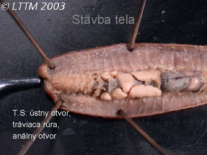 Stavba tela T. S: ústny otvor, tráviaca rúra, análny otvor 