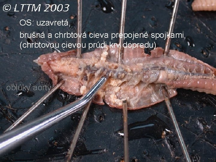 OS: uzavretá, brušná a chrbtová cieva prepojené spojkami, (chrbtovou cievou prúdi krv dopredu) oblúky