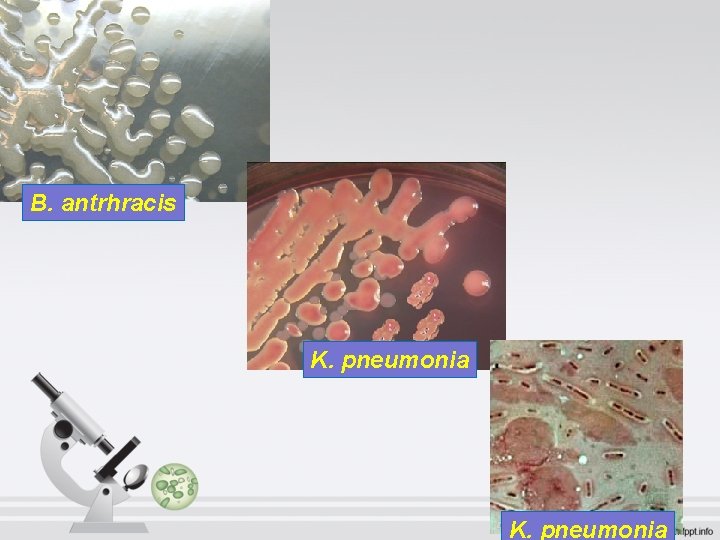 B. antrhracis K. pneumonia B. antrhracis K. pneumonia