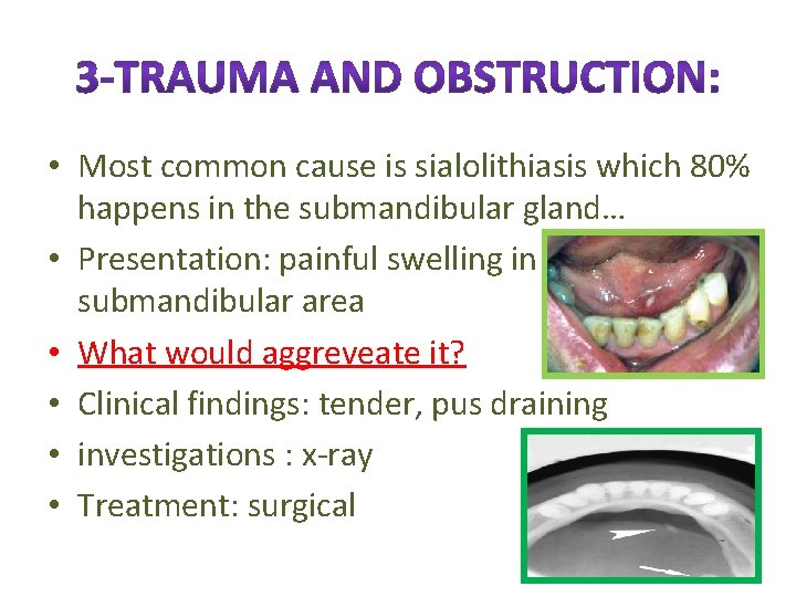  • Most common cause is sialolithiasis which 80% happens in the submandibular gland…