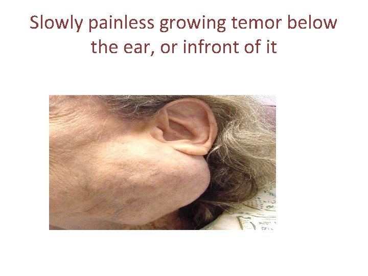 Slowly painless growing temor below the ear, or infront of it 
