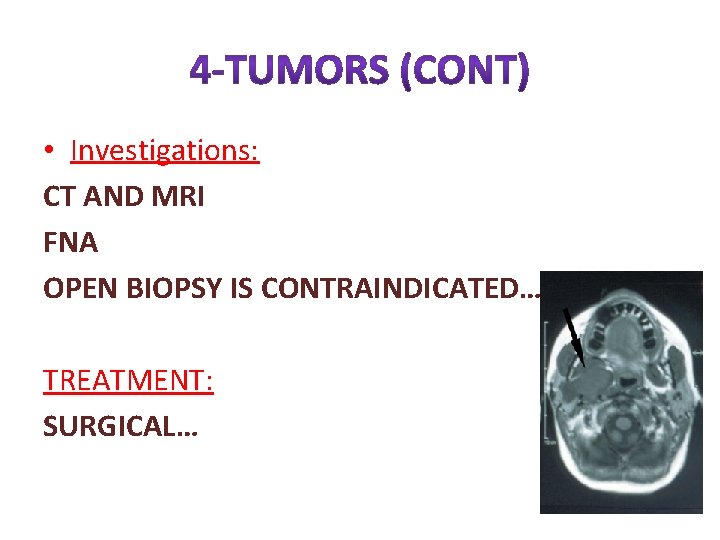  • Investigations: CT AND MRI FNA OPEN BIOPSY IS CONTRAINDICATED… TREATMENT: SURGICAL… 