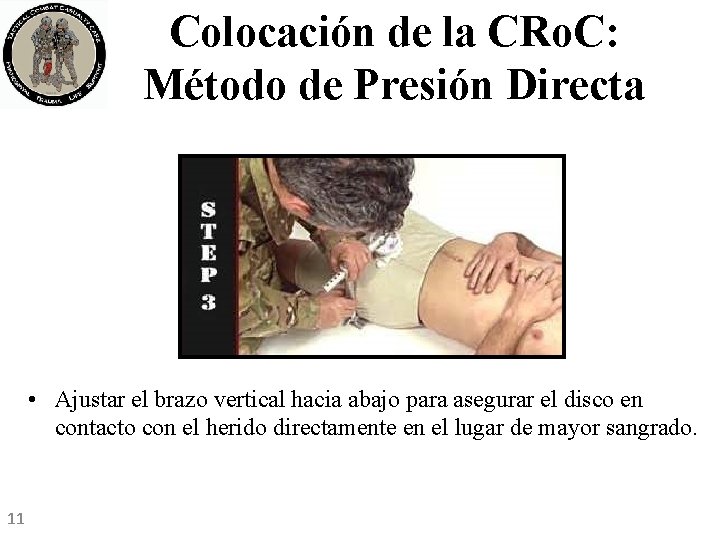 Colocación de la CRo. C: Método de Presión Directa • Ajustar el brazo vertical