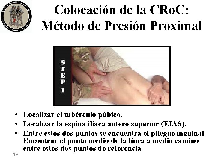 Colocación de la CRo. C: Método de Presión Proximal • Localizar el tubérculo púbico.