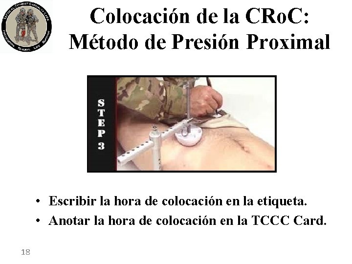 Colocación de la CRo. C: Método de Presión Proximal • Escribir la hora de