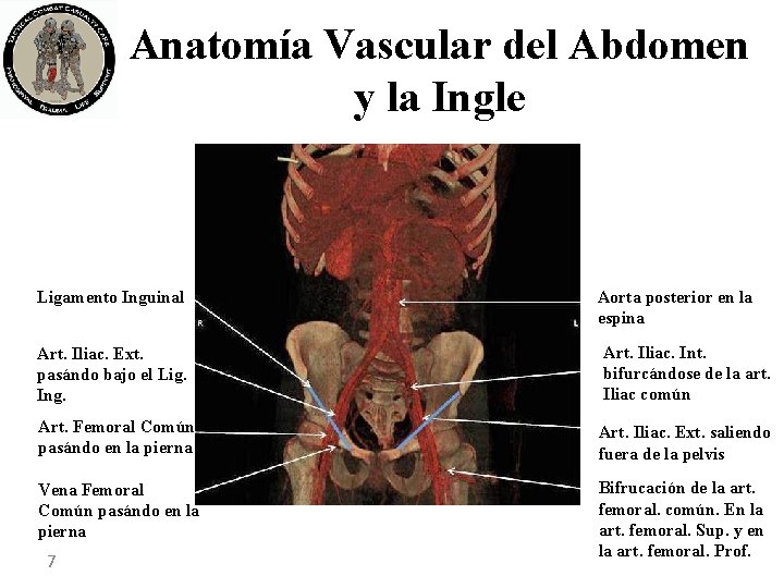 Anatomía Vascular del Abdomen y la Ingle Ligamento Inguinal Aorta posterior en la espina