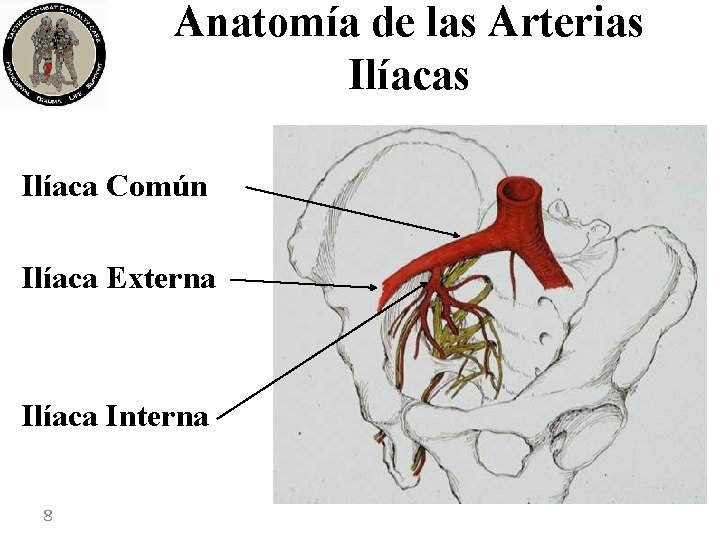 Anatomía de las Arterias Ilíaca Común Ilíaca Externa Ilíaca Interna 8 