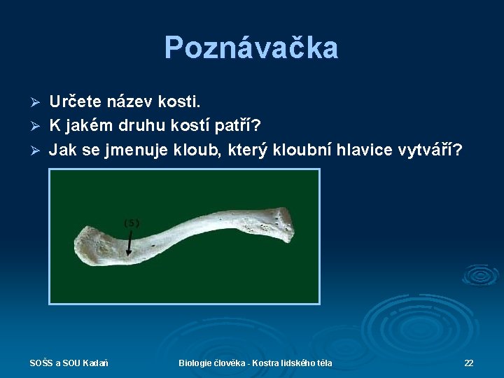 Poznávačka Určete název kosti. Ø K jakém druhu kostí patří? Ø Jak se jmenuje