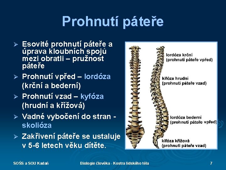 Prohnutí páteře Ø Ø Ø Esovité prohnutí páteře a úprava kloubních spojů mezi obratli