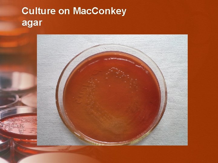Culture on Mac. Conkey agar 