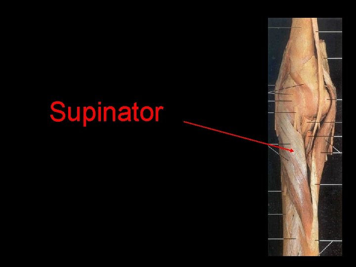 Supinator 