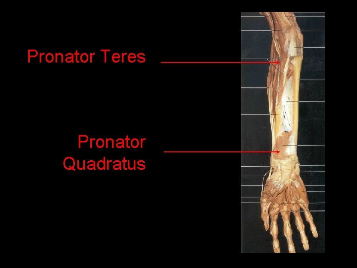 Pronator Teres Pronator Quadratus 