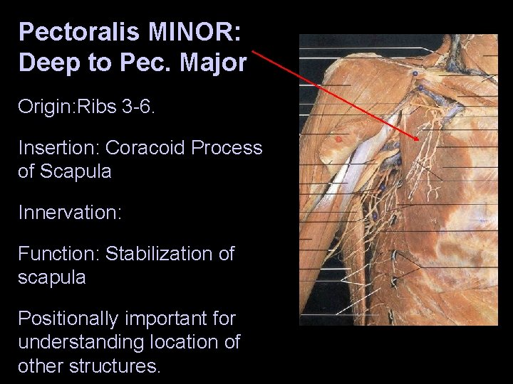 Pectoralis MINOR: Deep to Pec. Major Origin: Ribs 3 -6. Insertion: Coracoid Process of