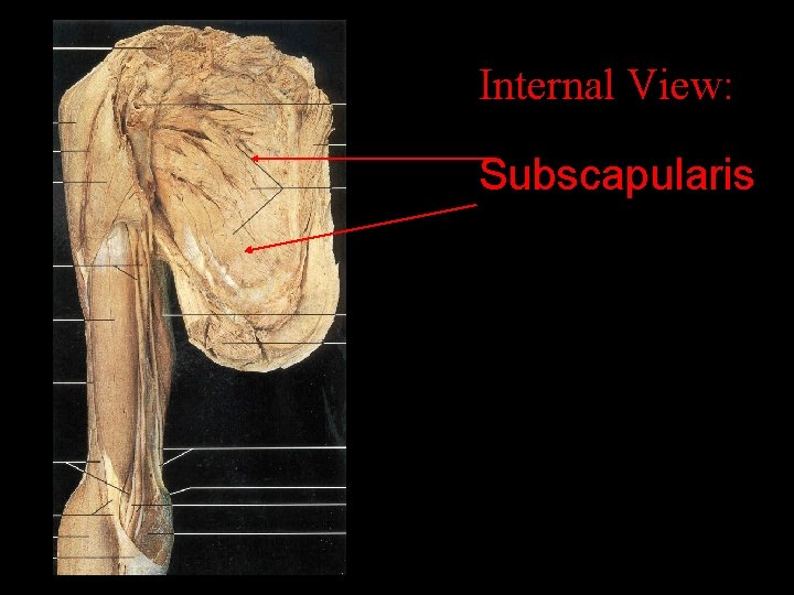 Internal View: Subscapularis 