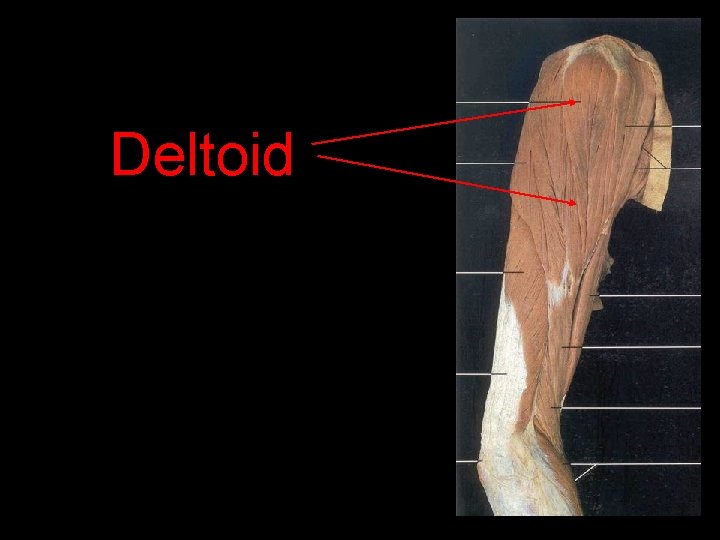 Deltoid 