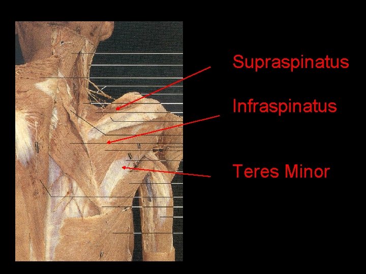 Supraspinatus Infraspinatus Teres Minor 