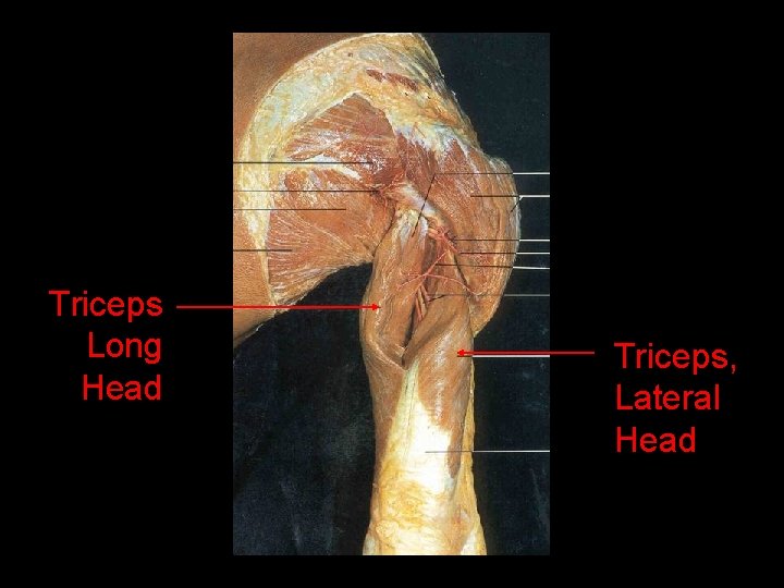 Triceps Long Head Triceps, Lateral Head 