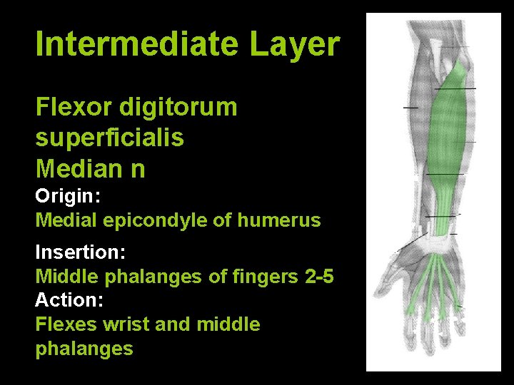 Intermediate Layer Flexor digitorum superficialis Median n Origin: Medial epicondyle of humerus Insertion: Middle