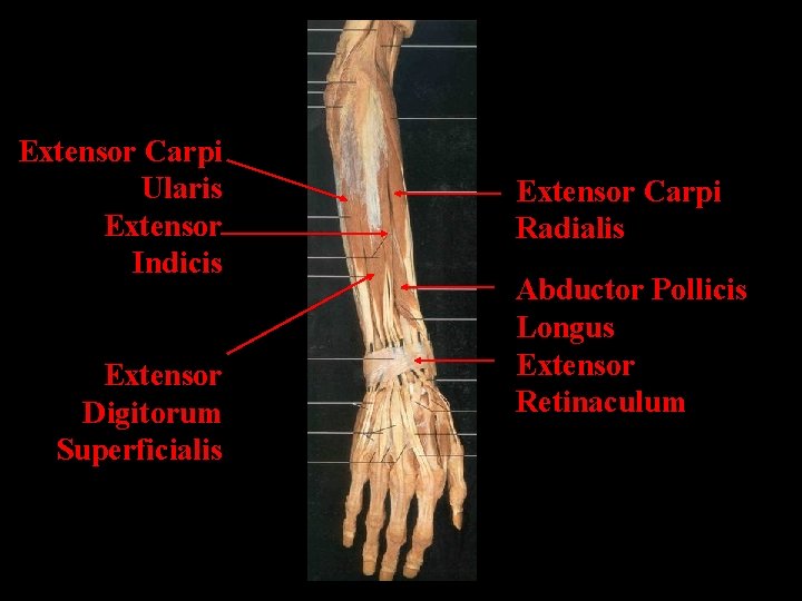Extensor Carpi Ularis Extensor Indicis Extensor Digitorum Superficialis Extensor Carpi Radialis Abductor Pollicis Longus