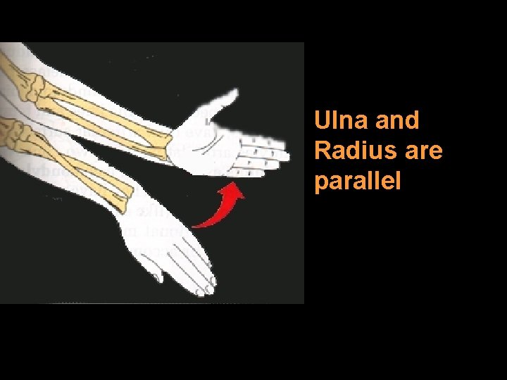 Ulna and Radius are parallel 