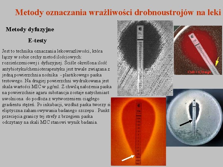 Metody oznaczania wrażliwości drobnoustrojów na leki Metody dyfuzyjne E-testy Jest to technika oznaczania lekowrażliwości,