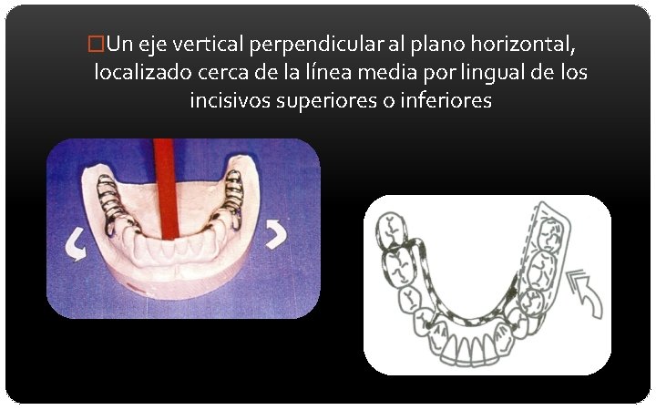 �Un eje vertical perpendicular al plano horizontal, localizado cerca de la línea media por