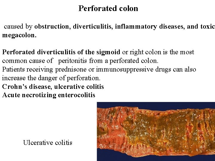 Perforated colon caused by obstruction, diverticulitis, inflammatory diseases, and toxic megacolon. Perforated diverticulitis of