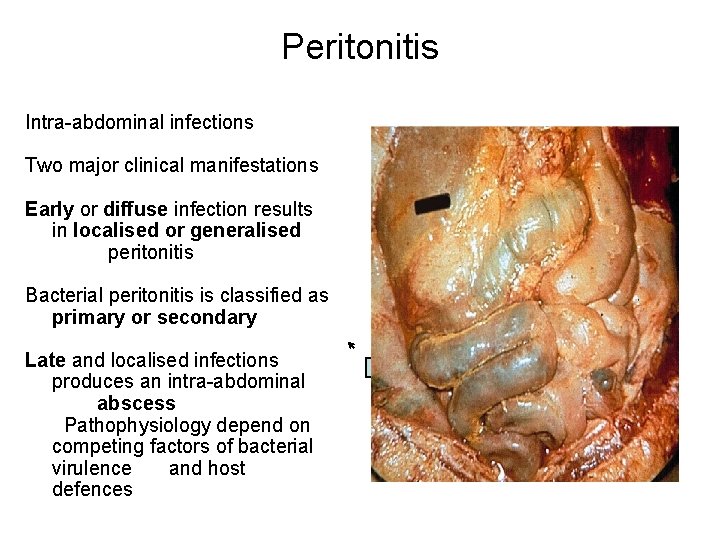 Peritonitis Intra-abdominal infections Two major clinical manifestations Early or diffuse infection results in localised