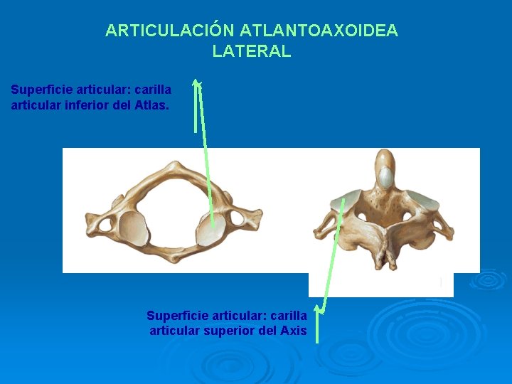 ARTICULACIÓN ATLANTOAXOIDEA LATERAL Superficie articular: carilla articular inferior del Atlas. Superficie articular: carilla articular