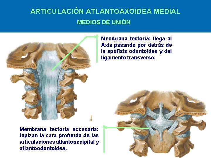 ARTICULACIÓN ATLANTOAXOIDEA MEDIAL MEDIOS DE UNIÓN Membrana tectoria: llega al Axis pasando por detrás