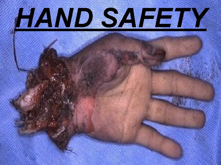 HAND SAFETY 