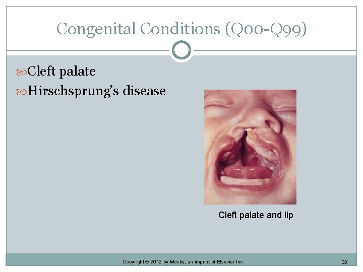 Congenital Conditions (Q 00 -Q 99) Cleft palate Hirschsprung’s disease Cleft palate and lip