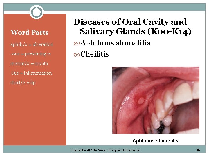 Word Parts aphth/o = ulceration -ous = pertaining to Diseases of Oral Cavity and