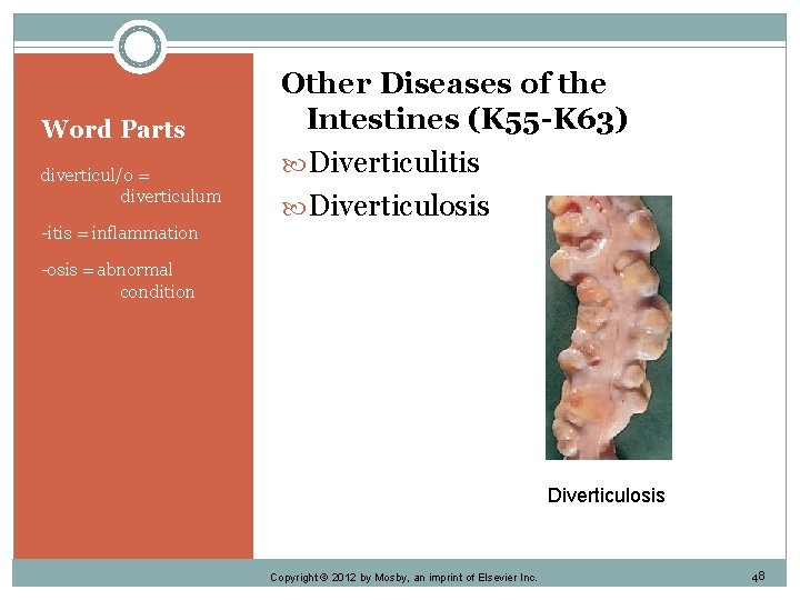 Word Parts diverticul/o = diverticulum Other Diseases of the Intestines (K 55 -K 63)