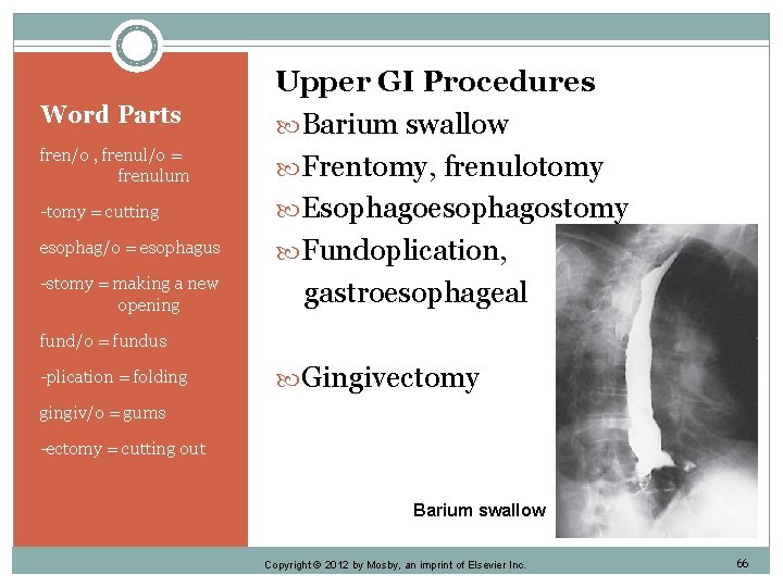 Word Parts fren/o , frenul/o = frenulum -tomy = cutting esophag/o = esophagus -stomy
