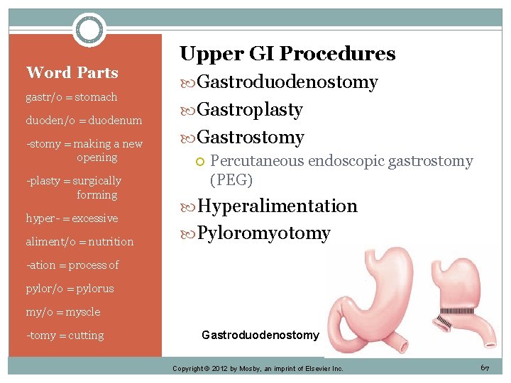Word Parts gastr/o = stomach duoden/o = duodenum -stomy = making a new opening