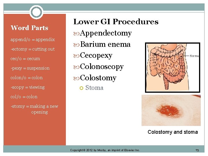 Word Parts append/o = appendix -ectomy = cutting out cec/o = cecum -pexy =