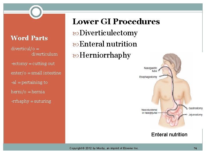 Word Parts diverticul/o = diverticulum Lower GI Procedures Diverticulectomy Enteral nutrition Herniorrhaphy -ectomy =