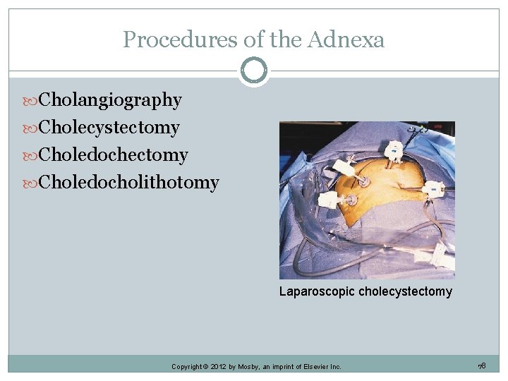 Procedures of the Adnexa Cholangiography Cholecystectomy Choledocholithotomy Laparoscopic cholecystectomy Copyright © 2012 by Mosby,